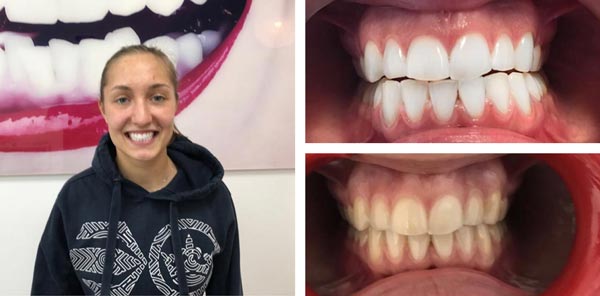 Before-After-5.jpg